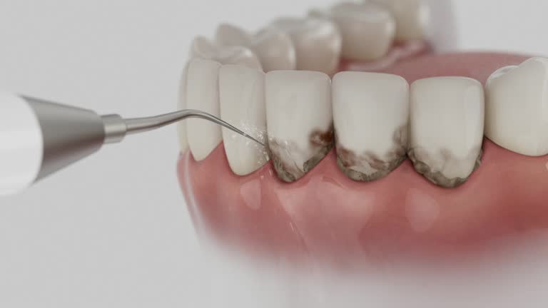 Trusted Dental Crowns And Bridges service in Bayou L'Ourse, LA - Dentist Open Now